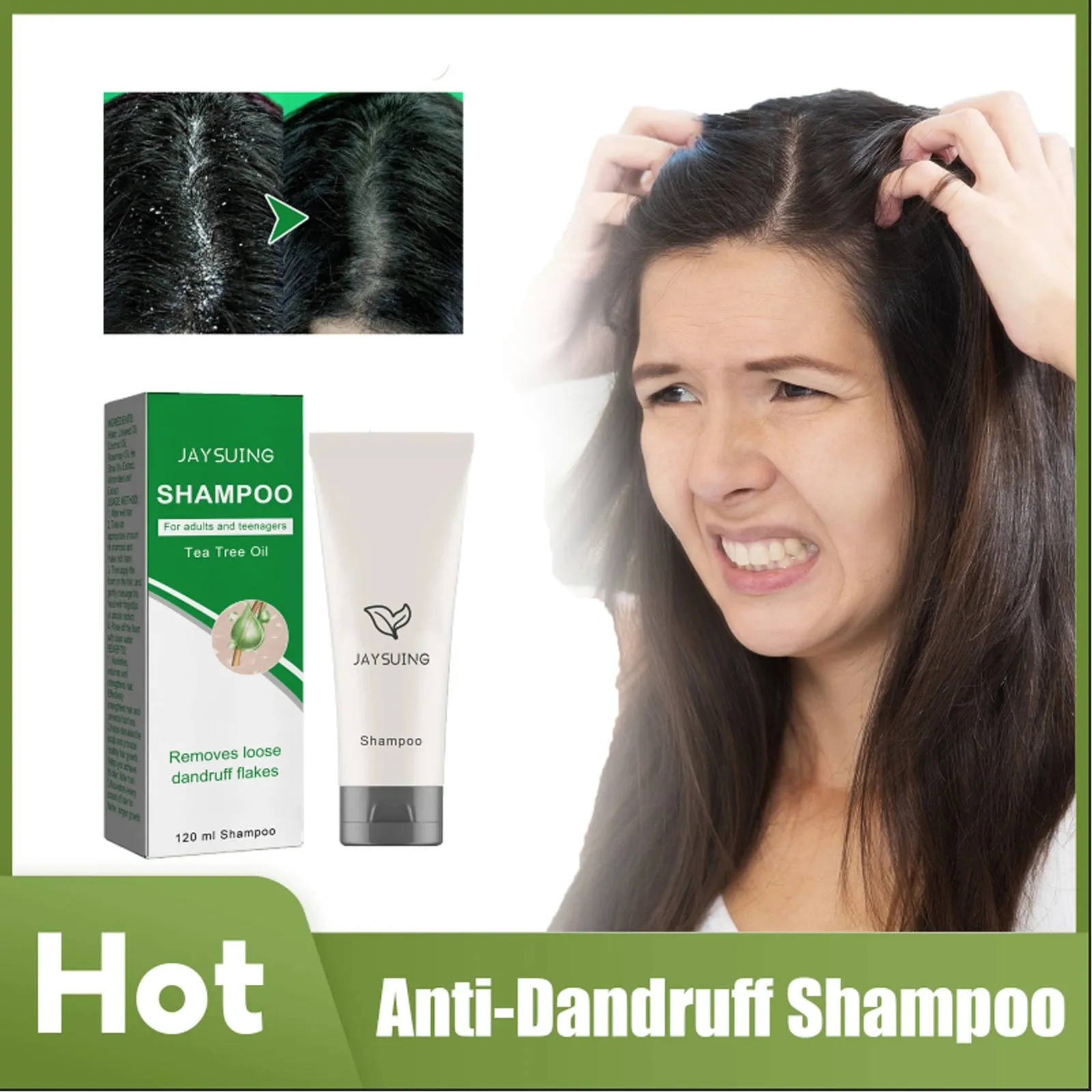 Scalp Cleansing Anti Dandruff Anti-Itching Shampoo Treatment for  Seborrheic Dermatitis & Oil Control while Strengthening Hair Roots & Smoothing Hair -32days shipping